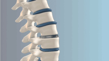 Spine